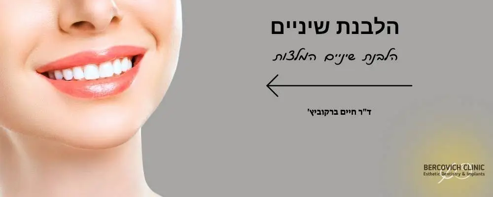 הלבנת שיניים