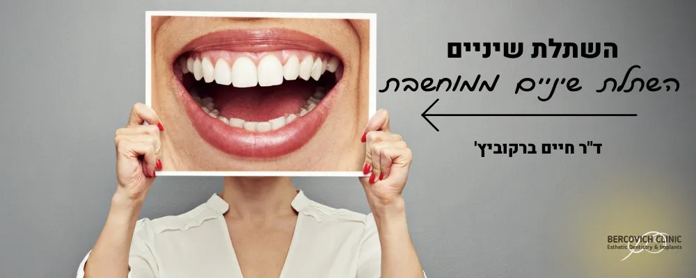 השתלת שיניים