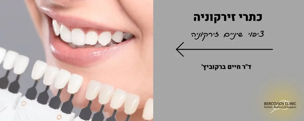 כתרי זירקוניה