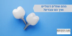 מהם שתלים דנטליים