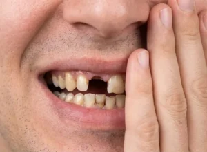 מטופל עם שיניים מכוערות שבורות