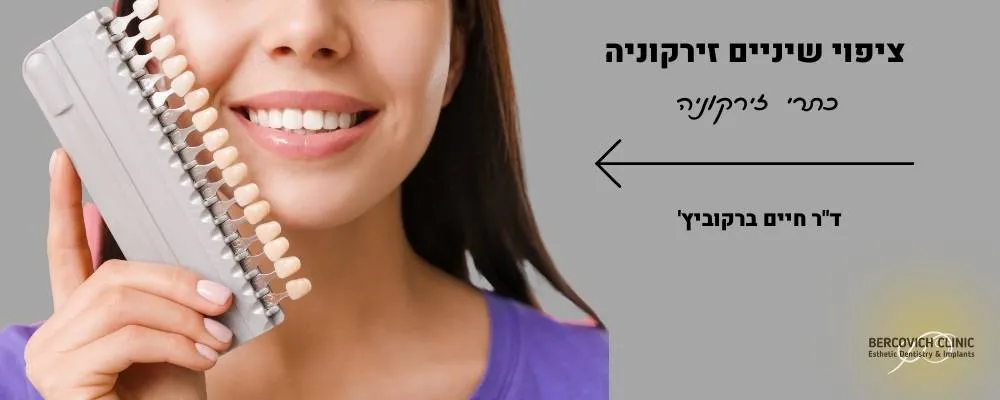 ציפוי שיניים זירקוניה